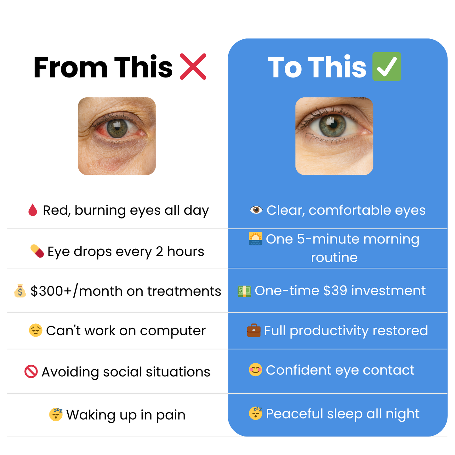 TheraEyes - 👁️The Quick & Easy Way to Relieve Dry Eyes (In 5 Minutes or Less)💦