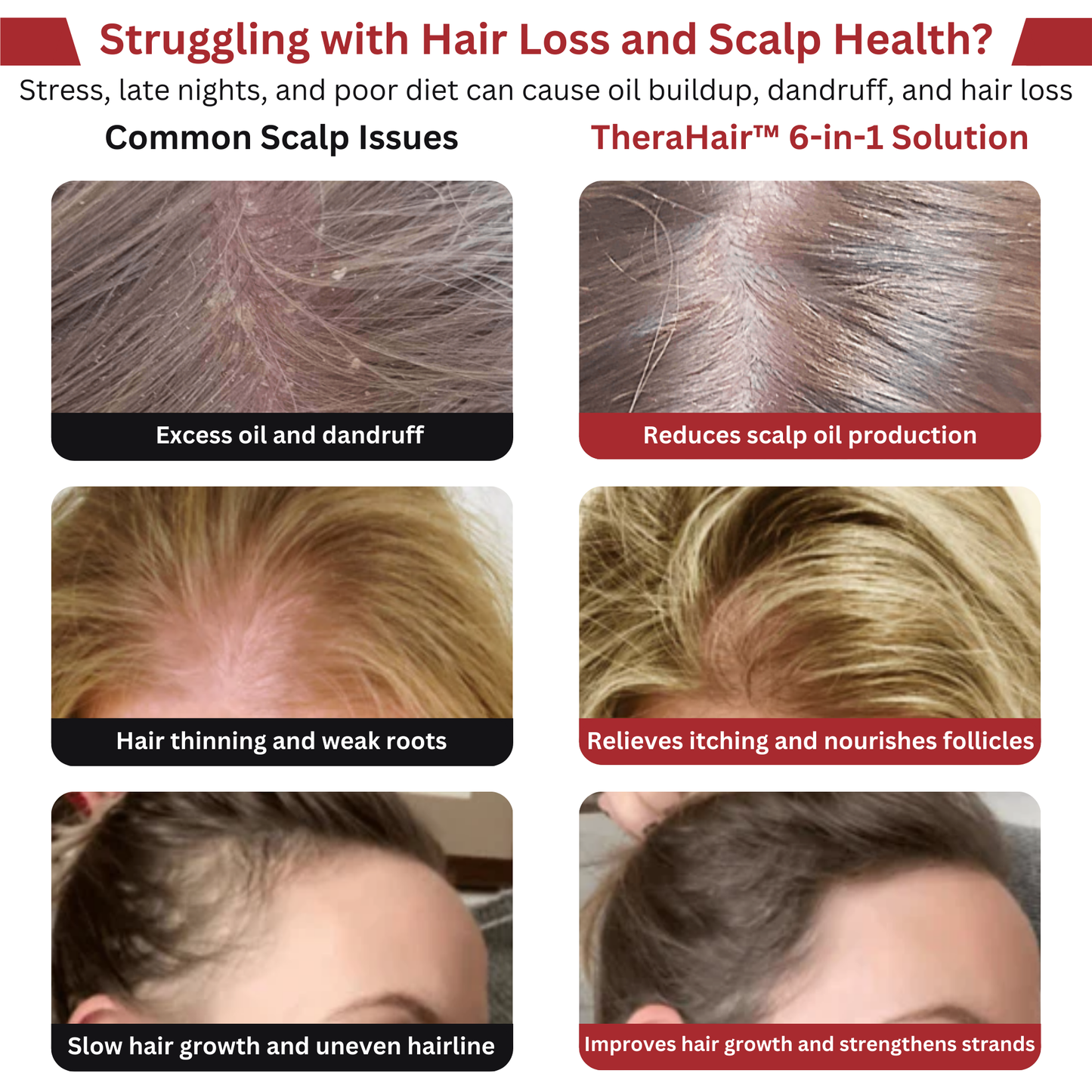 TheraHair™ Scalp Therapy Comb – Red Light, Massage & Serum Infuser (🎉FREE SHIPPING ONLY TODAY🚚)