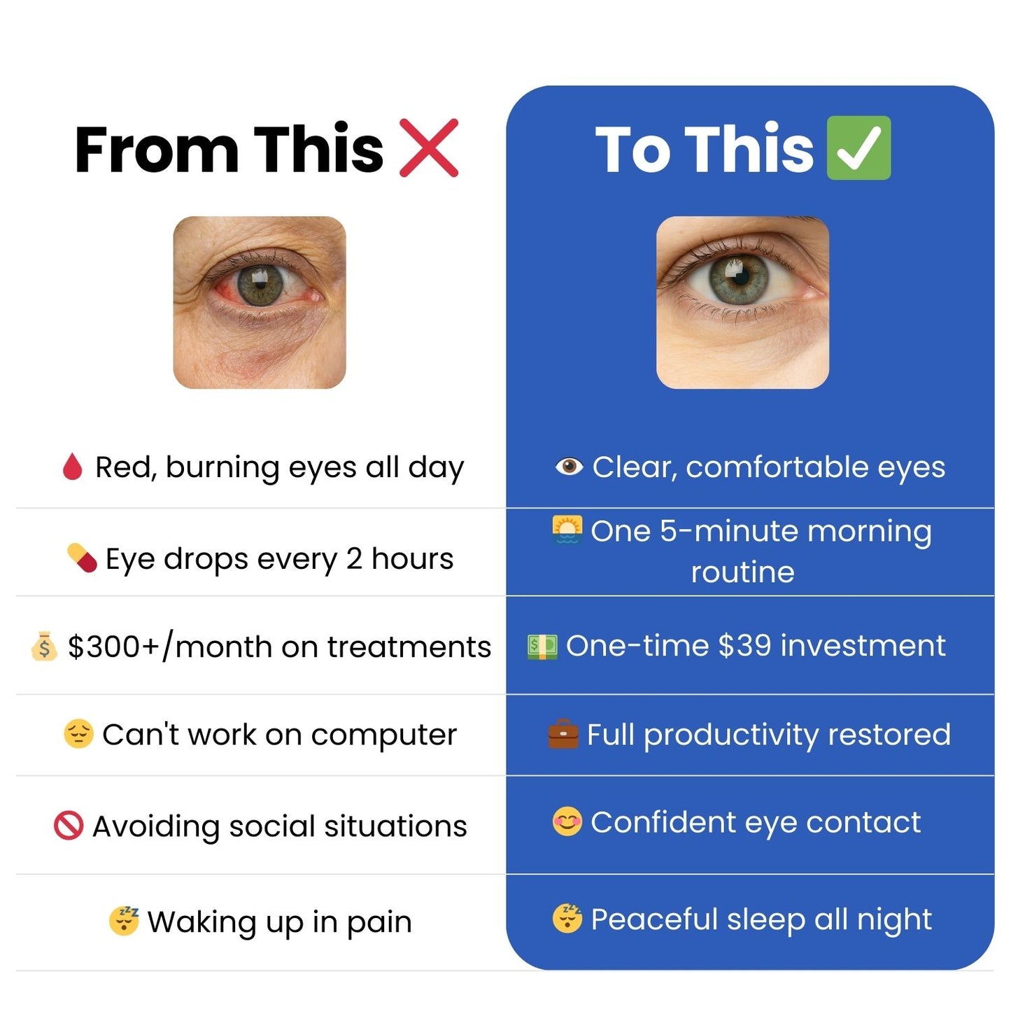 TheraEyes - 👁️The Quick & Easy Way to Relieve Dry Eyes (In 5 Minutes or Less)💦