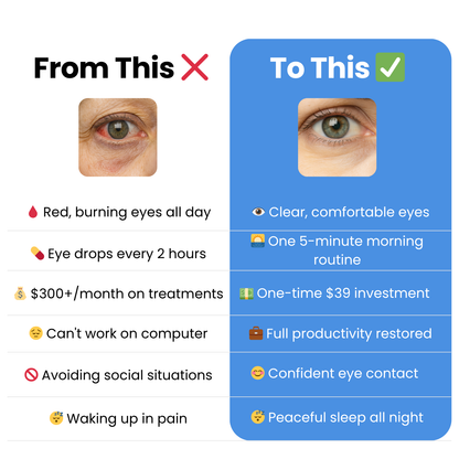 TheraEyes - 👁️The Quick & Easy Way to Relieve Dry Eyes (In 5 Minutes or Less)💦
